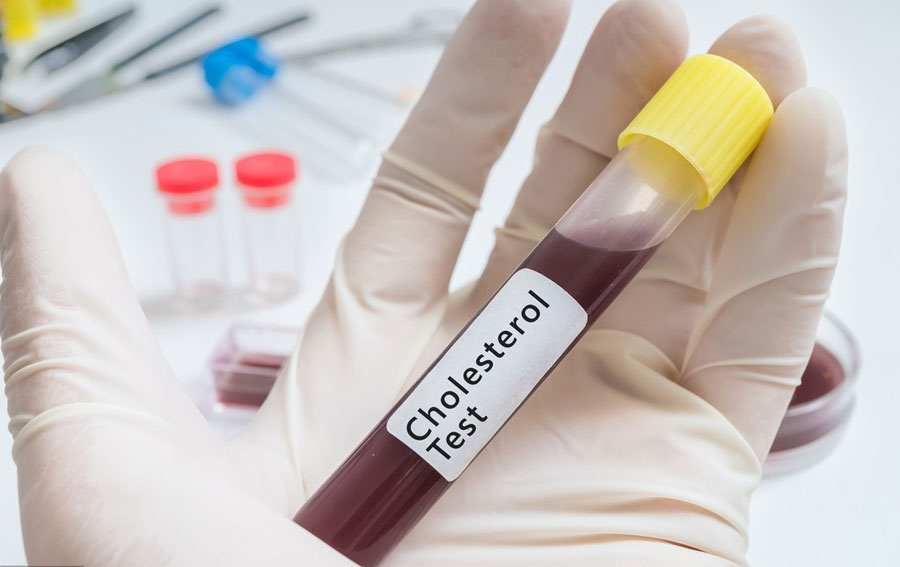 肾癌是什么原因引起的？肿瘤专家胡群峰提醒：这6种表现可能是肾癌早期征兆